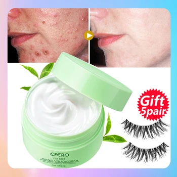 

EFERO Tea Tree Acne Face Cream Anti Acne Treatment Shrink Pore Scar Removal Whitening Hyaluronic Acid Moisturizing Acne Cream