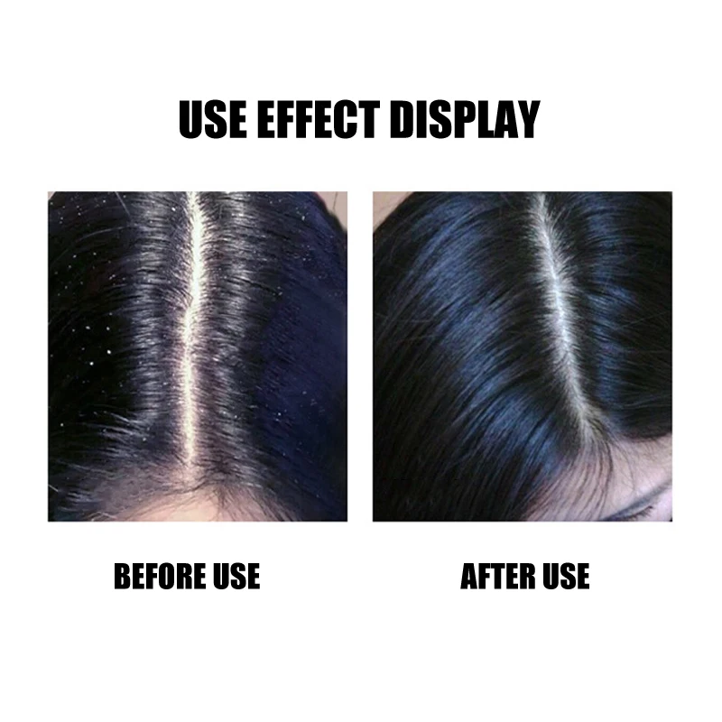 Sea Salt Anti-Dandruff Shampoo Cream Relieve Itching Control Oil Hair Shampoos Hair Care @ME88 Sea Salt Anti-Dandruff Shampoo Cream Relieve Itching Control Oil Hair Shampoos Hair Care @ME88