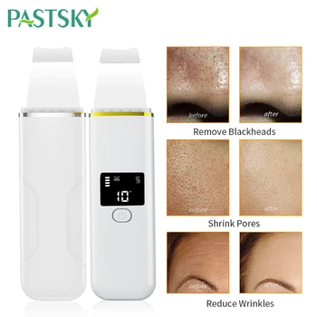 

Ultrasonic Skin Scrubber Ion Deep Face Cleaning Vibration Massager Acne Blackhead Removal Pore Cleaner Tool Face Spa Peeling