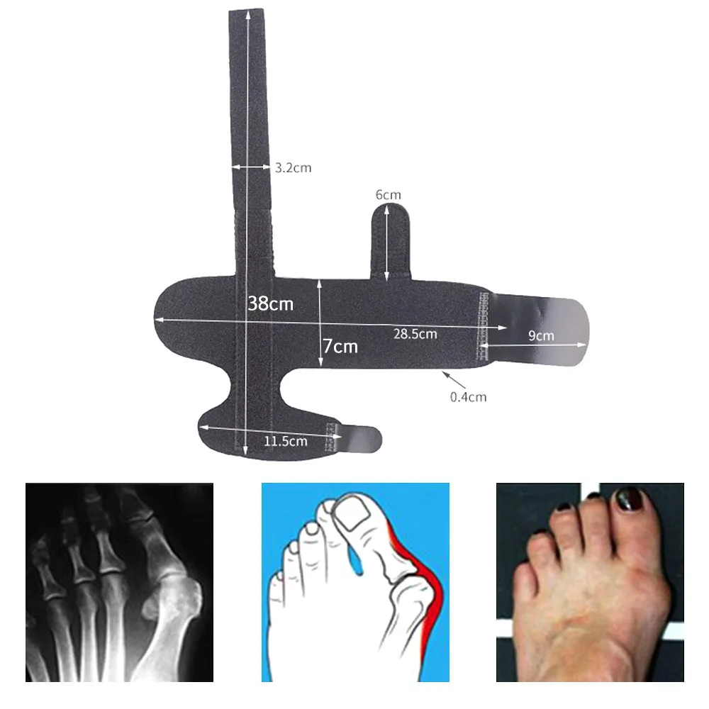 Bunion корректор шип Выпрямитель для ног поддержка пальцы ноги большой палец Ортез
