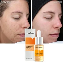 LANBENA Vitamin C Whitening Face Serum Lighten Spots Brightening Facial Skin Essence Fade Dark Spots Remove Freckle Skin Care