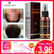 ARTISCARE спрей для роста выпадения волос масло для волос Кератиновое лечение волос предотвращает рост волос Nouish the scalp густые волосы