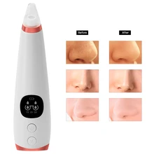 Очиститель лица для удаления черных точек вакуумный очиститель пор для лица Алмазная дермабразия машина для удаления акне инструменты для ухода за кожей