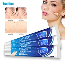 1/2/3 pces verruga remoção pomada verruga tratamento creme pescoço etiqueta da pele axila plana verruga pés calos extrato erval médico verruga creme