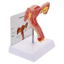 

1pc Anatomical Uterus Model Reproductive System Model for Training