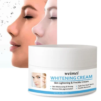 

50g Face Whitening Cream Powerful Whitening Freckle Cream Moisturizing Remove Acne Spots Pigment Dark Spots Skin Care Cream