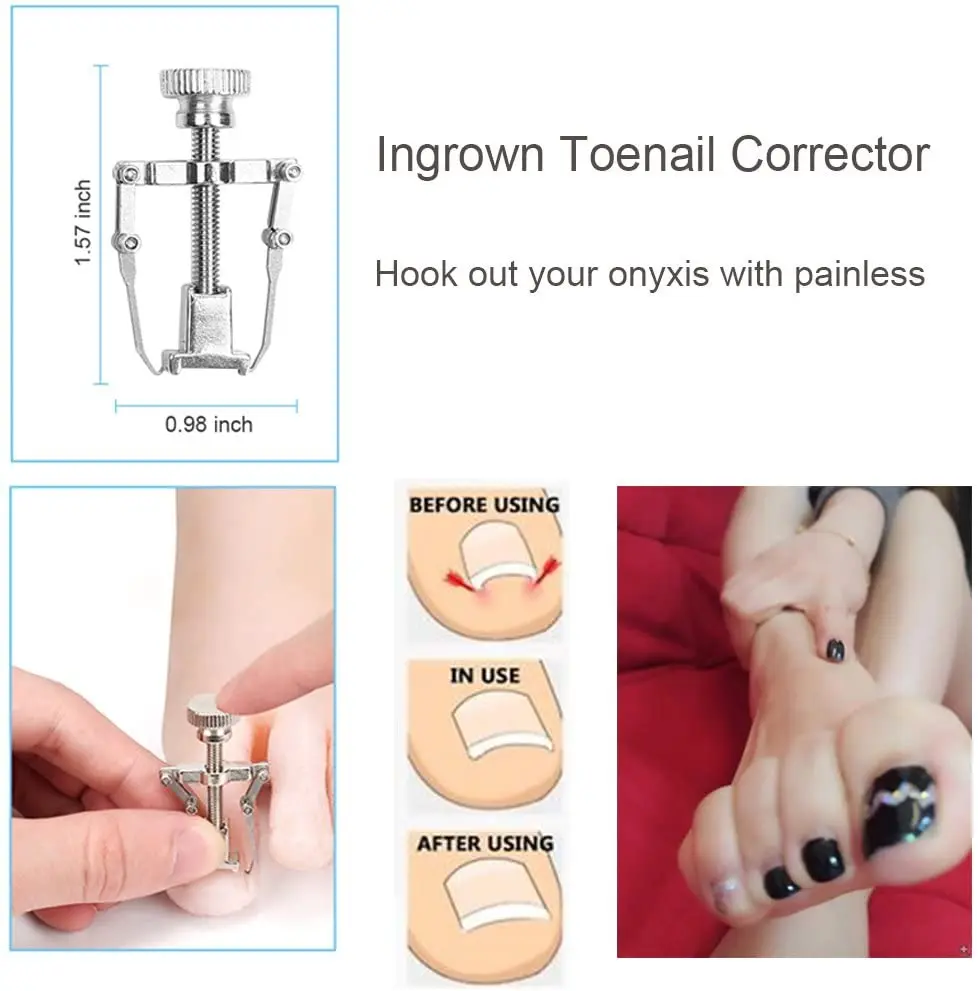 https://ae01.alicdn.com/kf/H258dd3f526414c9baf5d37f1b9606c23w/5-8-Pcs-Professional-Pedicure-Tools-Ingrown-Toenail-Tools-Kit-Nail-Care-Ingrown-Toenail-Removal-Correction.jpg