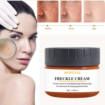

Powerful Spot Remover 50g Whitening Freckles Cream Tonico Facial Anti Aging Dark Spots Fade Beauty Face Cream The Ordinary TSLM1