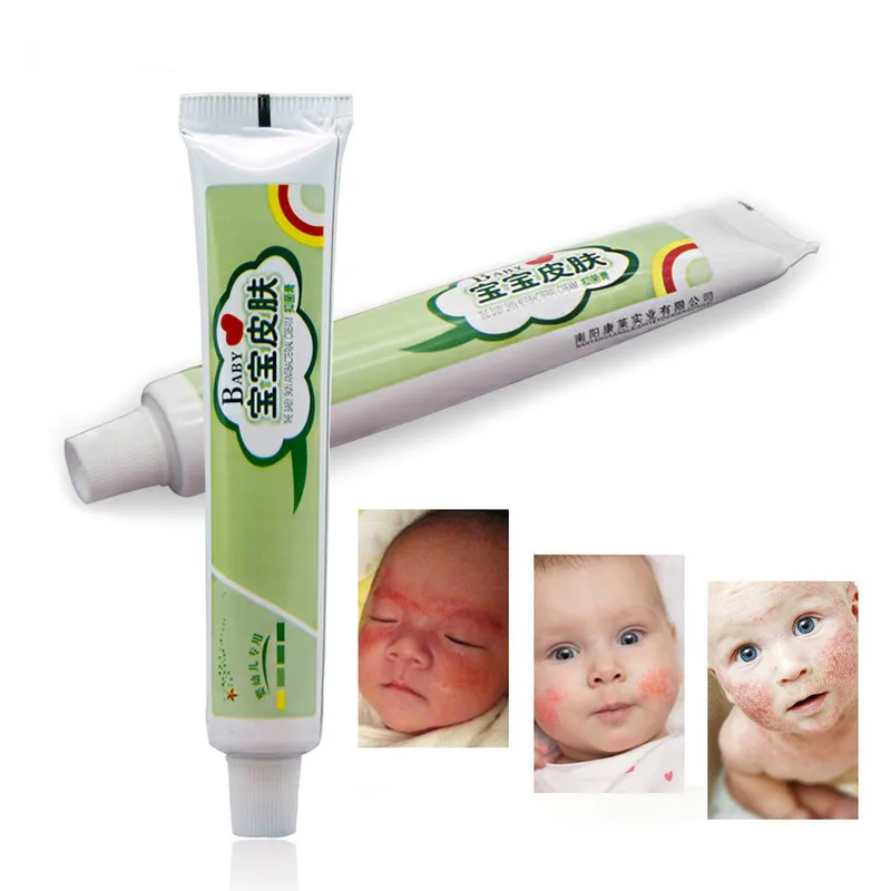 Buen valor Crema para reparar la piel del bebé, crema para Dermatitis, Eczema, crema para la picazón, Psoriasis, yeso chino de hierbas medicinales OnwZe8dnE3g