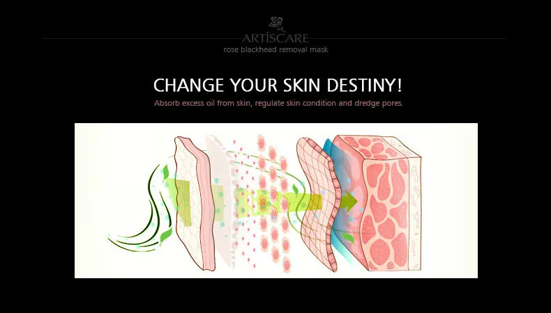 rose-blackhead-removal_04