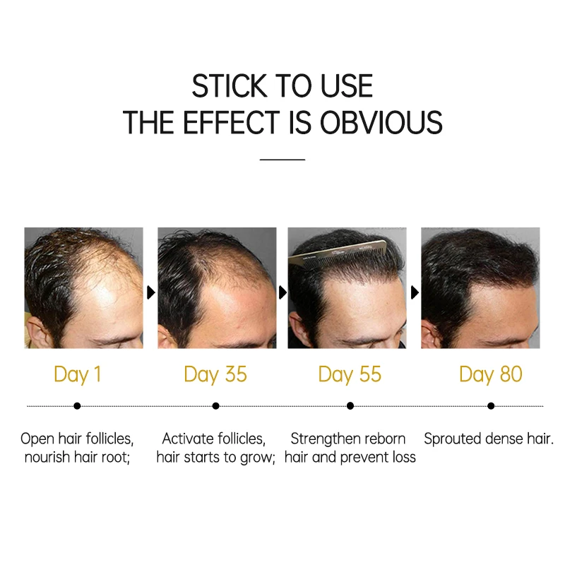 Top 134 + Scalp massage for hair growth reddit polarrunningexpeditions