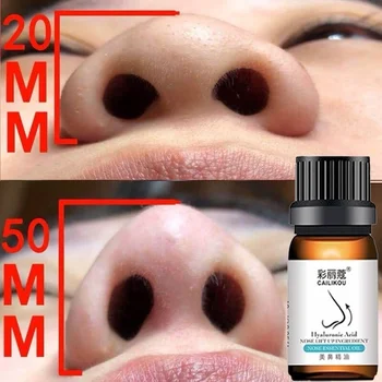 

100% Effective!Nose Up Heighten Rhinoplasty Essential Oil 30ml Nasal Bone Rmodeling Pure Natural Nose Care Thin Smaller Nose