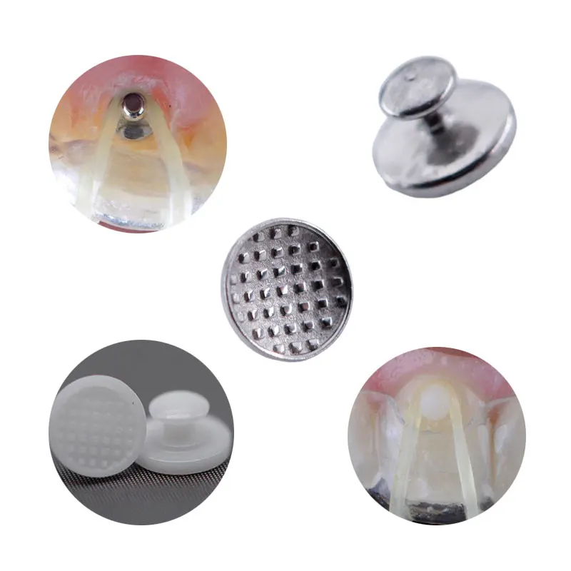 Рисунок 2 - скобы для зубных протезов