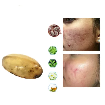 

Remove blackhead whitening, anti-allergic and anti-aging without adding Osmanthus fragrans essential oil and mild cleansing soap