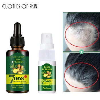 

Ginger Fast Hair Growth Serum + Spray 7 Days Hair Loss Treatment Germinal Hair Growth Essence Oil Men Women Anti Hair Loss Care