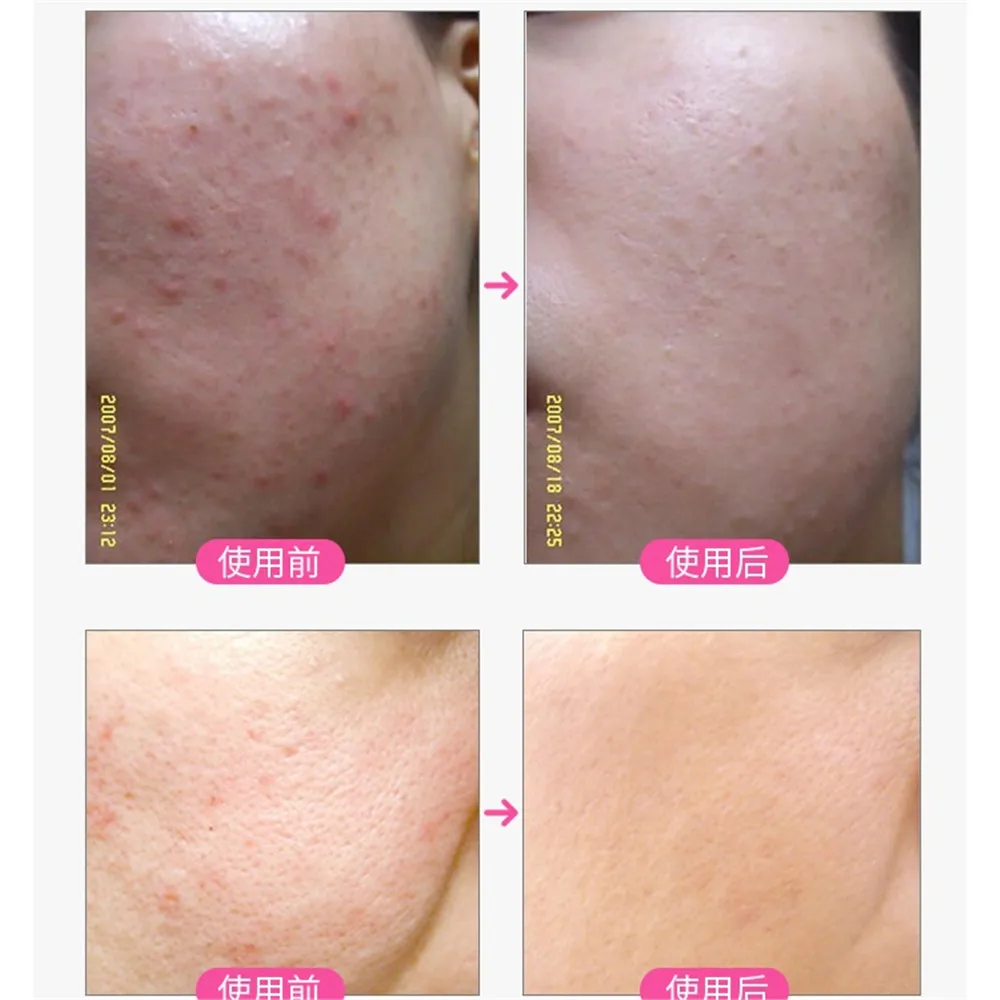 TB2XhzUlhuTBuNkHFNRXXc9qpXa_!!83916599