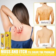 Psoriasis Cream Skin Cream Piebald Remove Moss Moss Sweat Stain Sweat Stain Itchy Skin Antibacterial Ointment Whitening Cream