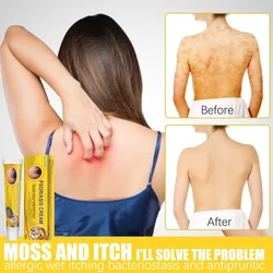 Psoriasis Cream Skin Cream Piebald Remove Moss Moss Sweat Stain Sweat Stain Itchy Skin Antibacterial Ointment Whitening Cream
