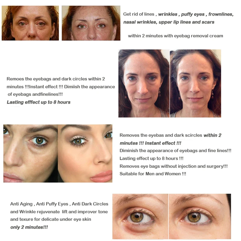 Customizable Eye Bag Removal Cream Long Lasting Effect