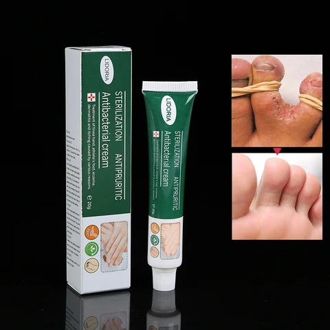 Anti Fungal Infections Hand Foot Cream For Athlete's Foot Pain Relief Beriberi Itch Erosion Peeling Blisters Feet Ointment