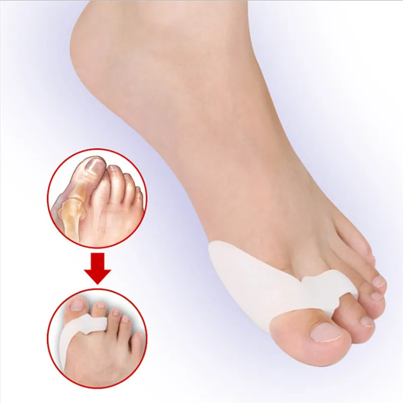 Separador de dedos de los pies de Gel de silicona, Corrector de juanetes Hallux Valgus, ortopédico, corrección de pulgar, pedicura, 1 par