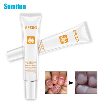 

Sumifun Nails Repair Essence Ointment Anti Infection Onychomycosis Nail Treatment Whitening Toe Nail Fungus Removal GelP1087
