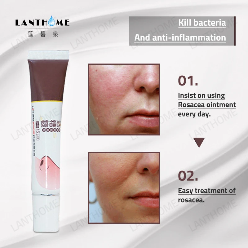 red a acne cream