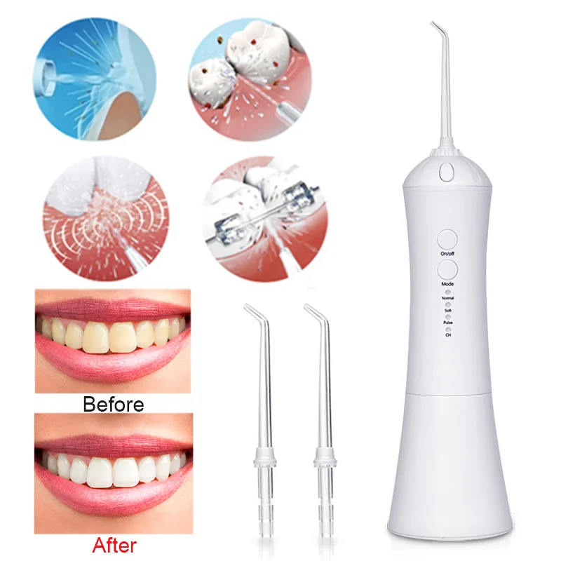Электрический беспроводной USB быстрая зарядка Стоматологическая спа машина отбеливание зубов для семьи стоматологическая flosser полива воды чистый рот