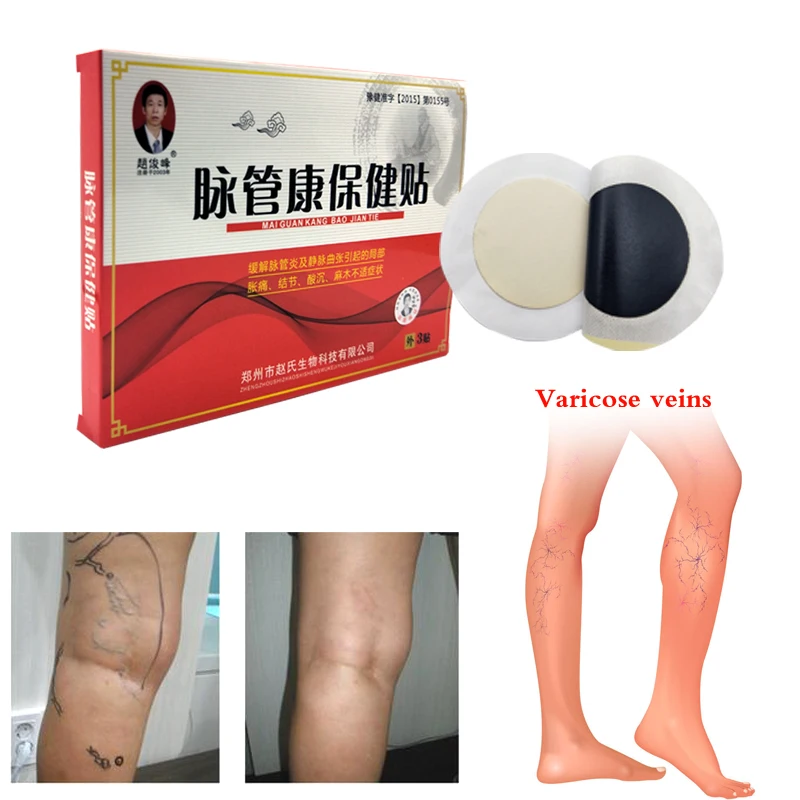 

4pcs Spider Veins Varicose Treatment Plaster Varicose Veins Cure Patch Vasculitis Natural Solution Herbal Patches