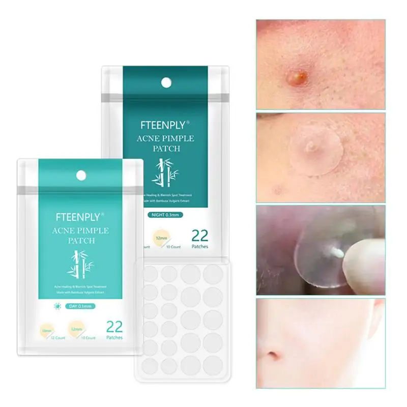 Ultra Thin Invisible Acne Patch,Conceals Acne ,Transparent Anti Acne Skin Stickers, Clean Pimple ,Day/Night Effect For Unisex