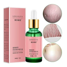 Средство для удаления ожирения послеродовые растяжки уход за телом против морщин Ремонт чистые натуральные Растяжки эфирные масла