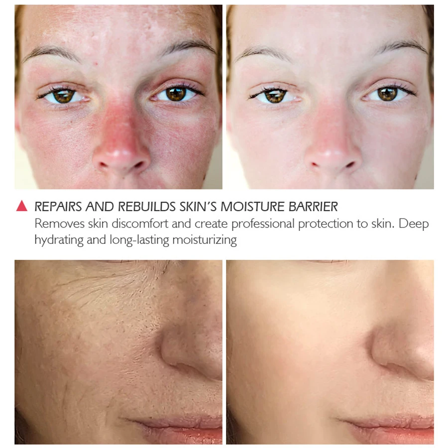 VIBRANT GLAMOUR Facial Essence100 authentic Moisturizing Anti Wrinkle Face Serum Whitening Anti allergy Deep Hydration SkinCare 4