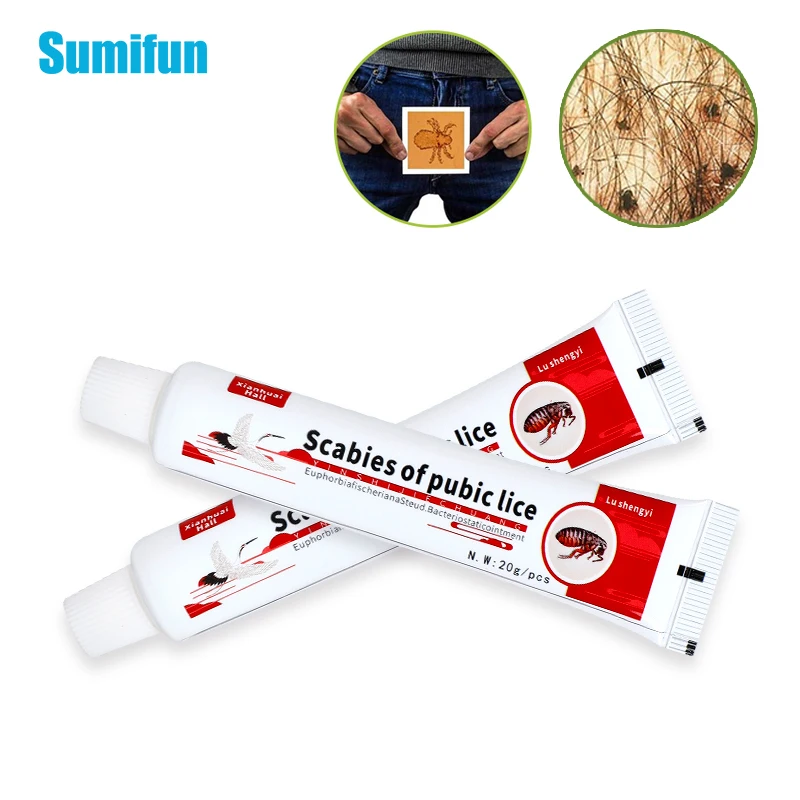 chinese anti itch cream
