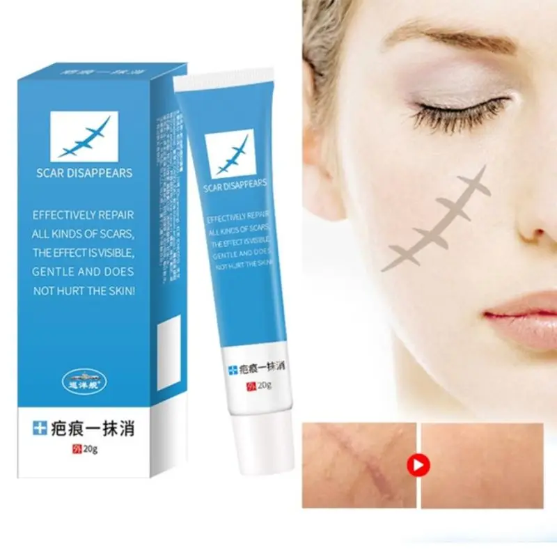 20g Herbal Scar Stretch Marks Removal Cream Acne Spot Stain Treatment Skin Repair Antibacterial Gel Relieve Itching Ointment | Красота и