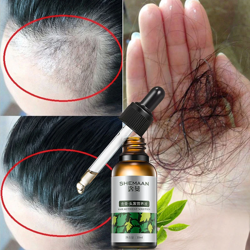 30 мл питательный жидкий питательный лосьон для волос, чтобы улучшить выпадение волос, жидкость для роста волос масло для волос TSLM1