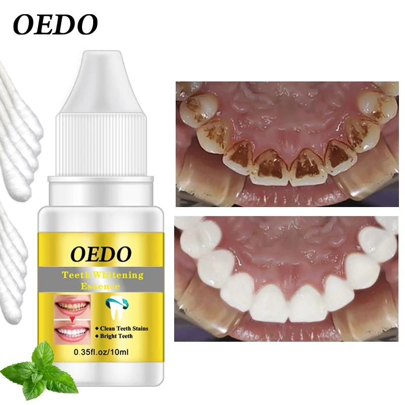 

OEDO Teeth Whitening Essence Oral Cleaning Removes Dental Stains and Plaques Yellow Tooth Essence Teeth Bleaching Tool Toothpast