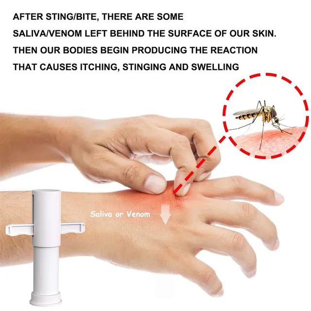 Venom Extractor Szivattyú Készlet Méreg Eltávolító Készletek Túlélési Felszerelés Elsősegély -Ellátás Vérvákuum Aspirátor Megfelelő Vészhelyzet - Image 3