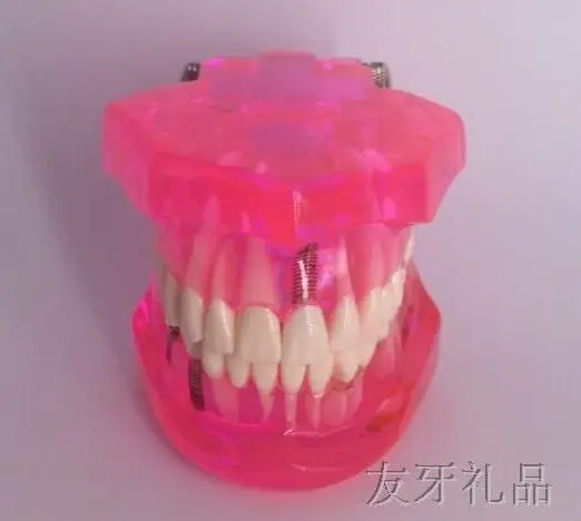 Medical Science Tooth model Adult transparent pathological planting repair model Oral cavity models