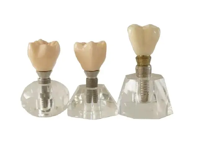Medical Science tooth model Transparent crystal implant models Removable implant free shipping