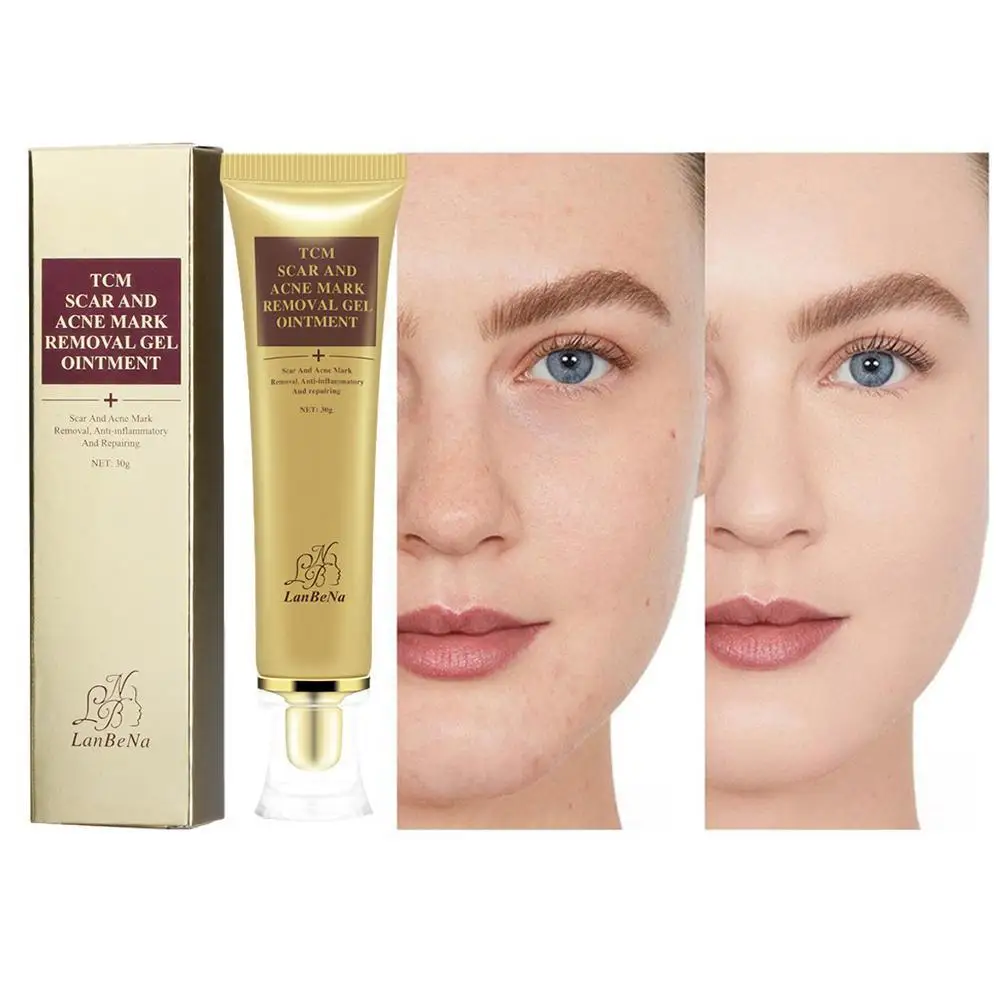 

LANBENA 30g Scar Removal Blackhead Acne Skin Care Treatment Dot Against Black Ginseng Cream Extract Cream Bleaching Q6L9