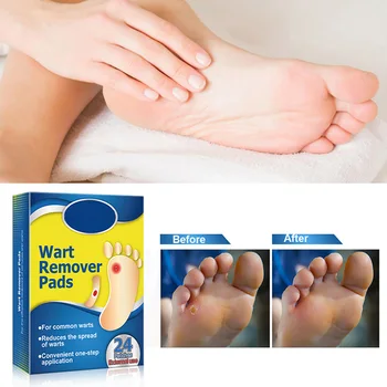 

24pcs/set Corn Stickers Corn Eye Cream Foot Patch Painless Foot Removal Plantar Wart Calluses Foot Calluses Foot Pain Relief