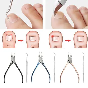 

Ingrown Toe Manicure Set Nail Cuticle Scissor Paronychia Trimmer Foot 2pcs/set Clipper Care Correction Tool Podiatry Chirop U8N0