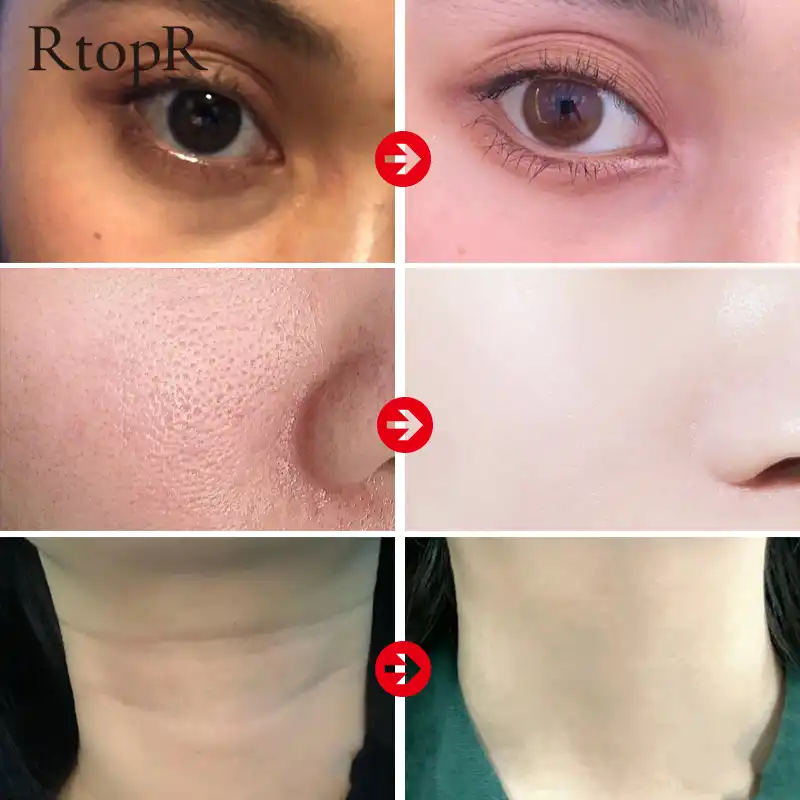 Rtopr マンゴー引き締めスキンに潤いアンチエイジング首クリーム毛穴収縮改善くすみオリーブ Peptid クリームスキンケアセット 顔用セルフタナー ブロンザー Aliexpress