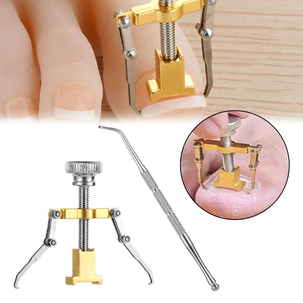 

2021 Professional Effectiv Treatment Ingrown Toenail Correction Pedicure Tools Paronychia Foot Care Nail Recover Tools