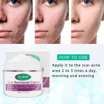 

Scar Removal Cream Stretch Marks Relief Acne Mark Removal Burns Repair Scars Acne Cream Repair Whitening Skin Care Body Cream