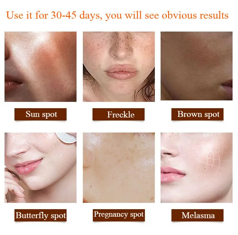 alpha arbutin moisturizer