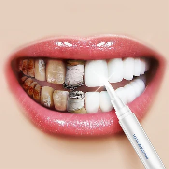 

White Teeth Whitening Pen Tooth Gel Whitener Bleach Remove Plaque Stains Dental Tools Oral Hygiene Teeth Cleaning Serum