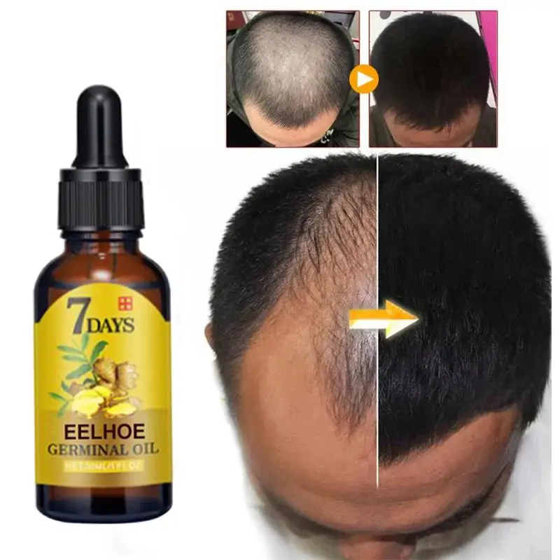 Tónico para el cabello de jengibre para hombres y mujeres, aceite de jengibre para el cuidado del cabello hidratante, tratamiento de nutrición para la pérdida de cabello, 7 días