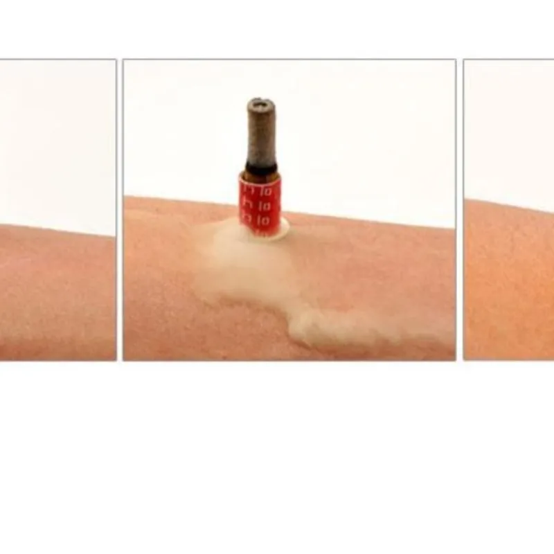 Moxa stick 50 grain of moxa candle five years Chen 40:1 moxibustion stick Chinese mugwort article moxibustion instrument YiZhuYi