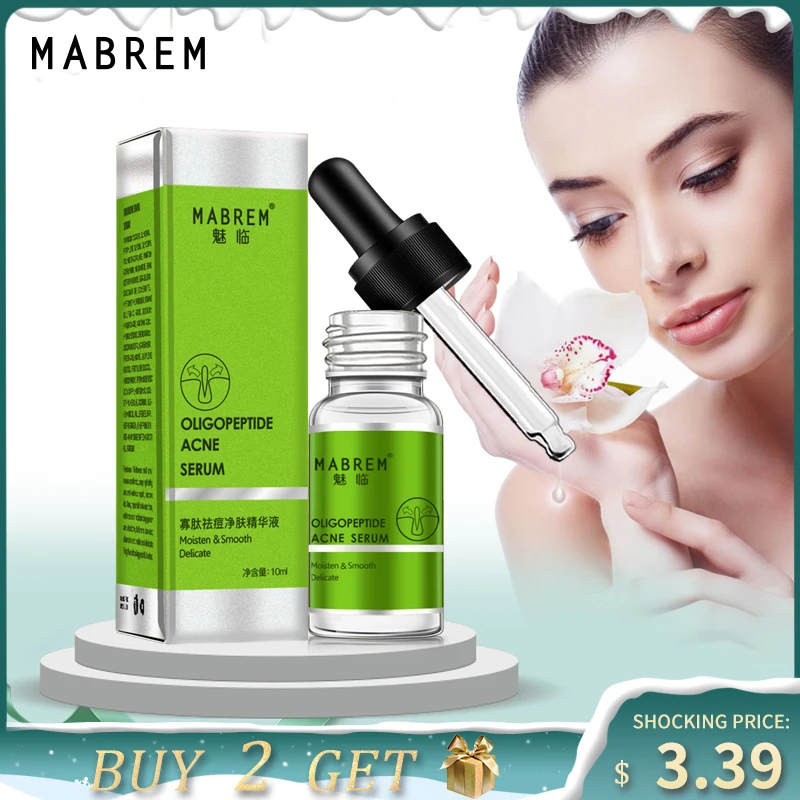380.46руб. 40% СКИДКА|Олигопептид акне очищающий лосьон сыворотка лечение акне крем восстановление и отбеливание пор анти Anging Winkles эссенция увлажняющая 10 мл-in Сыворотка from Красота и здоровье on AliExpress 
